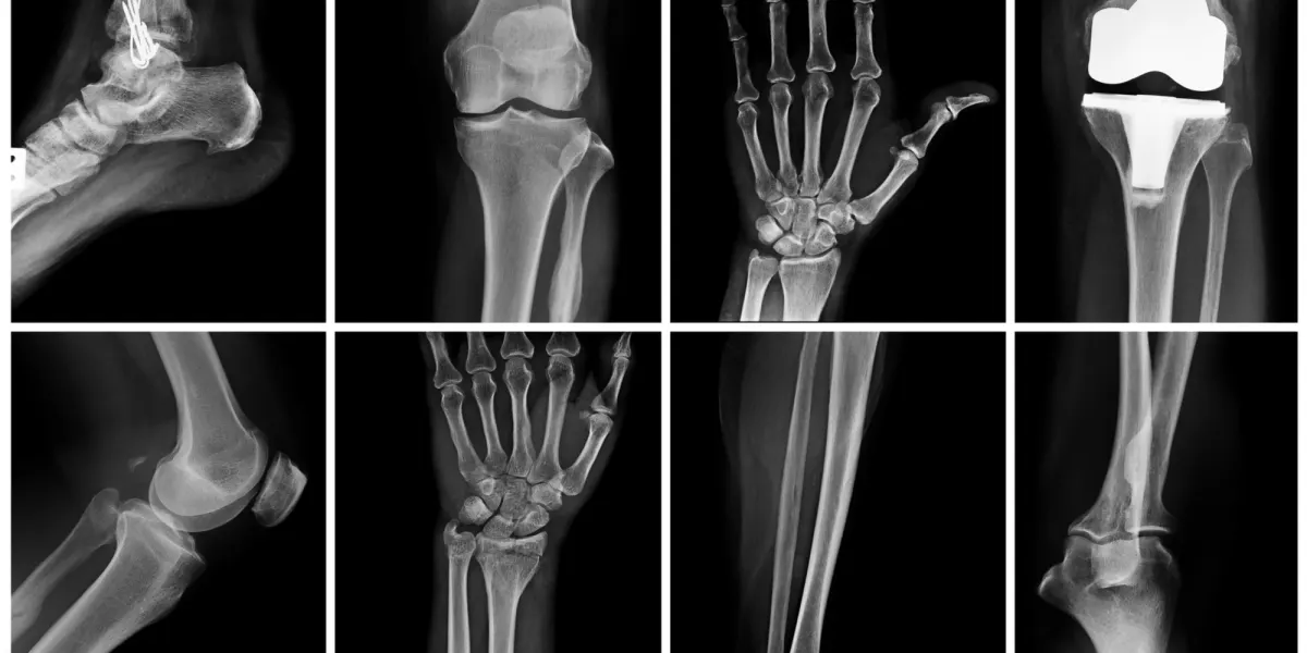 Knowing Normal: Experience Vs. Reading Books in Radiology