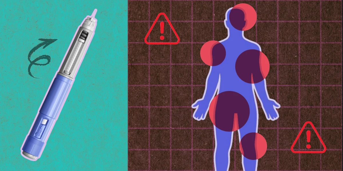 glp 1 thinning hair Weight Loss and Hair Loss